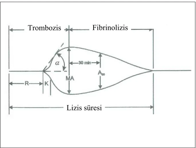 Şekil 3. Hemostaz kinetiğinin TEG ile değerlendirilmesi 