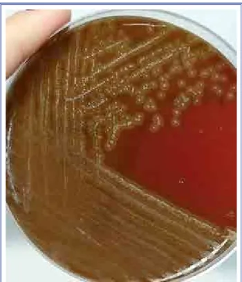 Figure 3.  Gram staining of Erysipelothrix rhusiopathiae. Figure 4. etation on the tricuspid valve