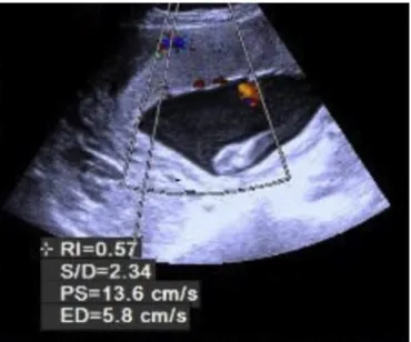 Fig. 2. Sample measurement on calculating resistivity index from placenta.718T.B. Bildacı et al