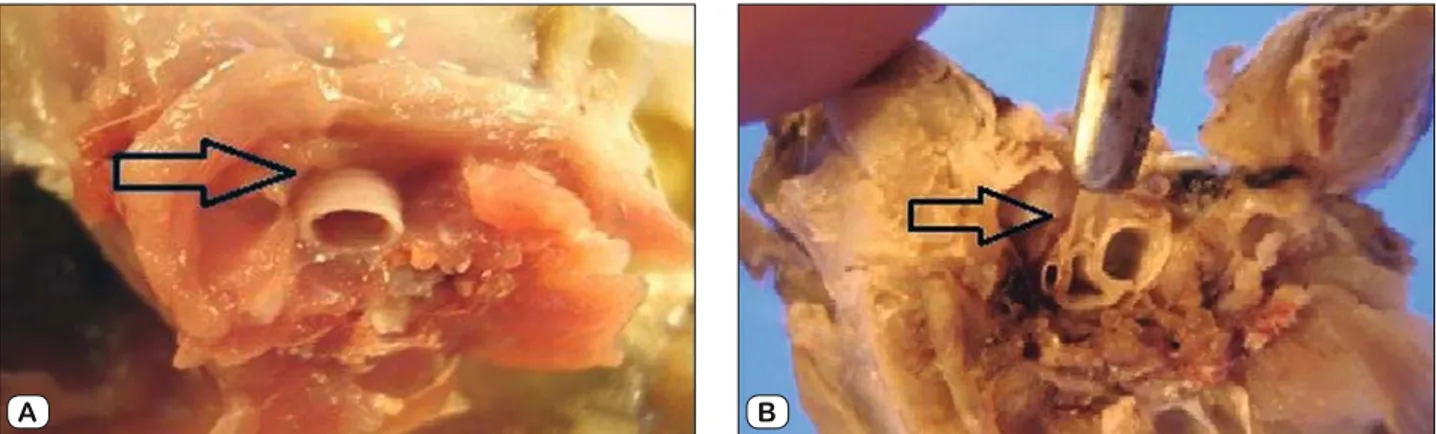 Fig. 1. Macroscopic appearance of paratracheal region (a) shows that anterior and lateral tracheal region is free of adhesions, (b) shows the  dense adhesions at the same region in sham group.