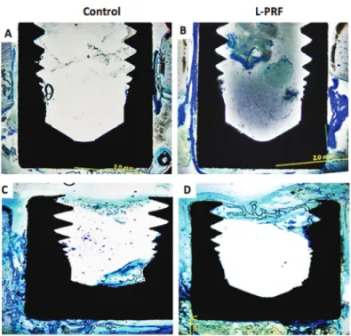 Fig. 3.    Photographs of the histological sections seen by light microscopy at sec- sec-ond and fourth week view of the image in test and control groups