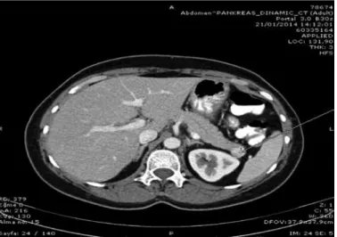 Table 1. Documentation of the laboratory analyses of the patient on  admission 