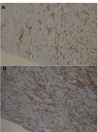 Figure 3. Distribution of microvessel density (CD34 þ) in the control and cancer groups