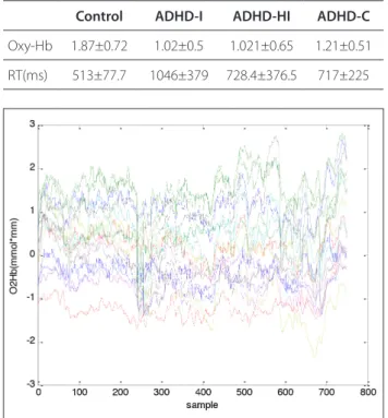 Figure 2. a, b. Filtered fNIRS signal for channel 13 (a) and averaged target responses (b)Figure 1