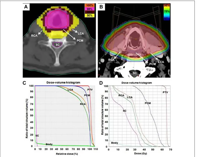 Figure 2. Isodose curves on an axial slice for a representative case planned with (A) helical tomotherapy-intensity-modulated radiotherapy plan