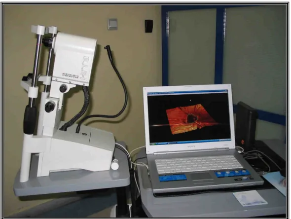 Şekil 3.4. Heidelberg Retina Tomografisi III 