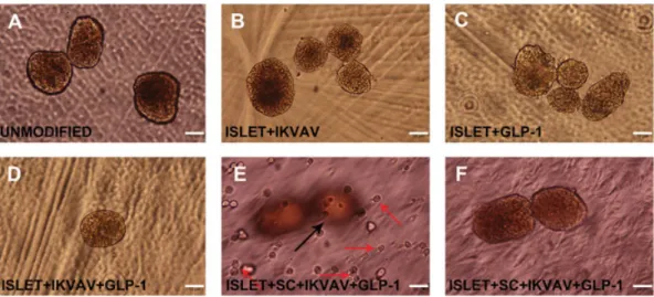 Figure 3. Optical microcope images of islets (20 islets/hydrogel) or islets + MSCs (20 islets + 20 000 MSCs/hydrogel) encapsulated within ligand functional PEG hydrogel scaffold ([IKVAV] = 2.5 m M and [GLP-1] = 20 μ M )