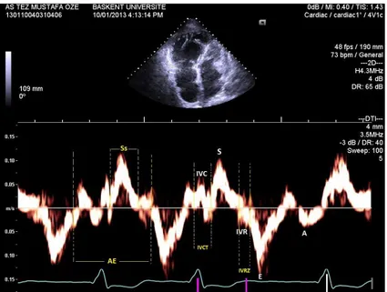 Şekil 3.11.Triküspit Anülüs Doku Doppler Hız ve Zaman Aralıklarının Ölçümü 