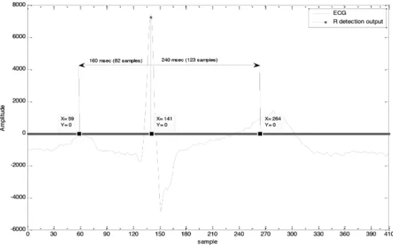 Figure 2. Illustration of the time intervals of calculated complexity