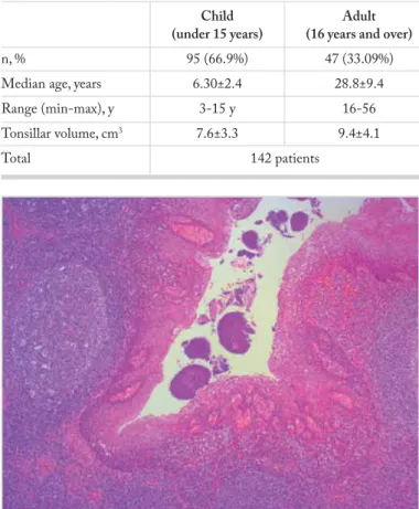 Figure 1. Actinomyces colonies in the tonsillar crypt lumen and  leukocyte infiltration with polymorphic nucleus in the crypt epithelium