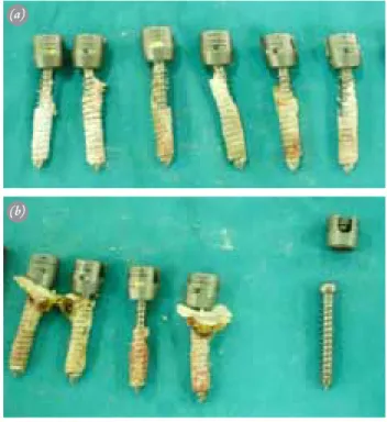 Fig. 2.  All vertebrae were embedded into cement from anterior sides  and pull-out tests were performed using a material testing  instrument