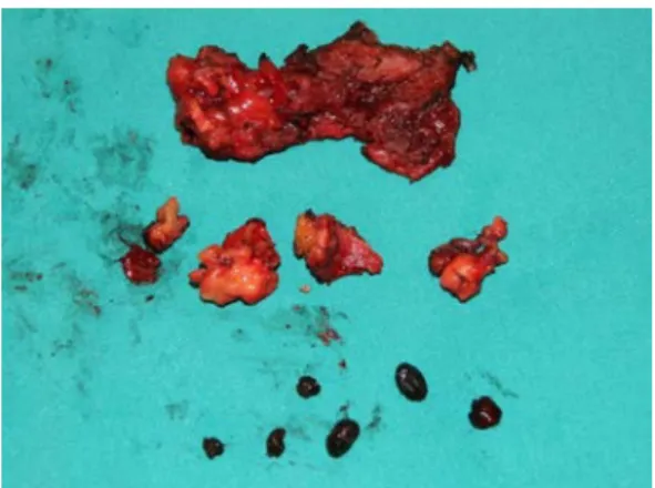 Figure 2. Intraoperative view 