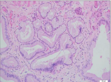 Table ııı: Distribution of certain major epithelial lesions by geographical regions Marmara 