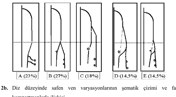 ġekil 2b.   Diz  düzeyinde  safen  ven  varyasyonlarının  şematik  çizimi  ve  fasiyal 