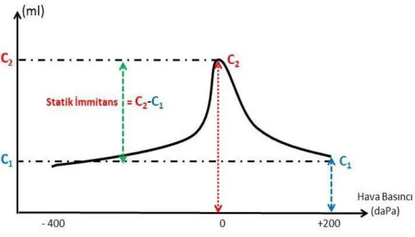 ġekil 5: Timpanogram parametreleri 