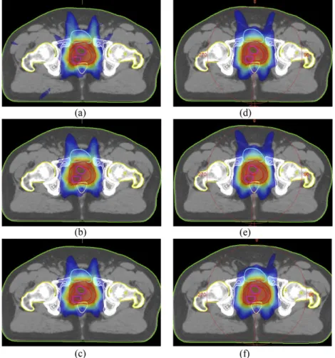 Figure 2 shows representative axial sections depicting dose