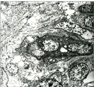 Table I: A review of the vaginal SFT cases in the literature
