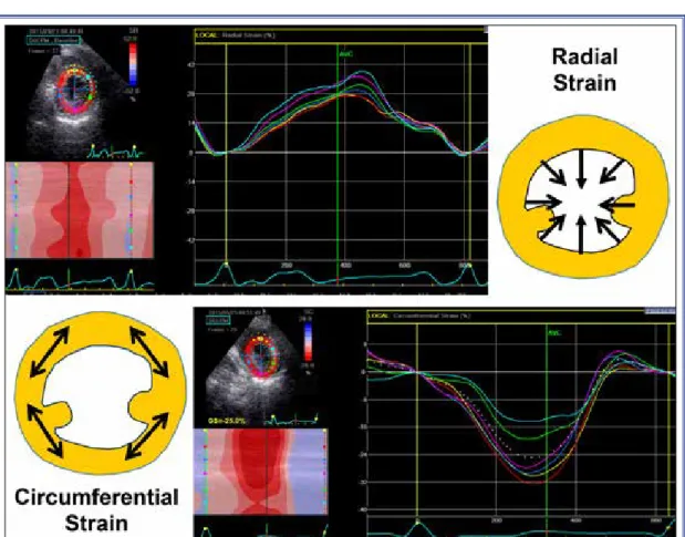 Figure 4.  The upper panel displays the radial segmental thickening, and the lower panel illustrates circumferential 