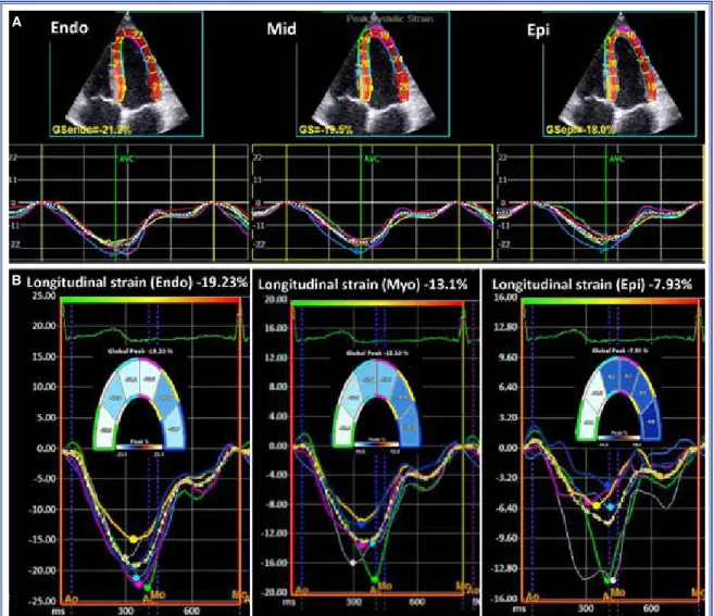 Figure  11.   Layer-specific  strain  analyses.  Endocardial,  mid-myocardial,  and  epicardial  segmental  longitudinal 