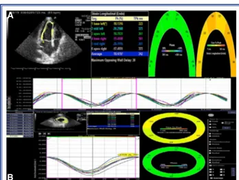 Figure 2.  (A) Left ventricular longitudinal strain curves from  6  segments  of  the  apical  4-chamber  view  are  seen