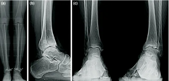 FIGURE 4. Preoperative (a) anteroposterior and (b,c) lateral radiographies of Case 2.(a)(b)(c)