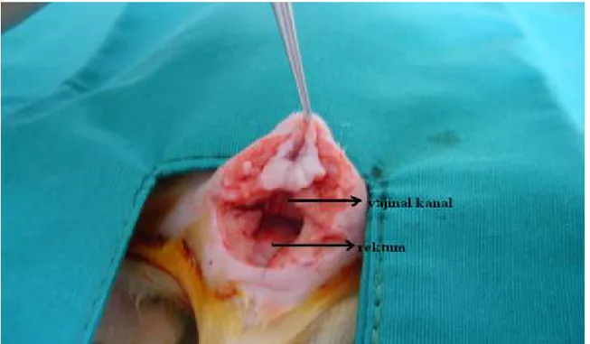 Şekil 3.3. Dişi sıçanda vajinal kanalla rektum arasına yapılan künt diseksiyon 