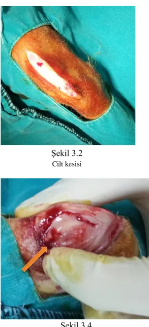 ġekil 3.1  Cerrahi öncesi hazırlık 