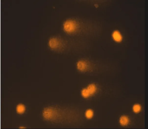 Şekil 2.4 Comet Analizi ile elde edilen örnek mikrografi 