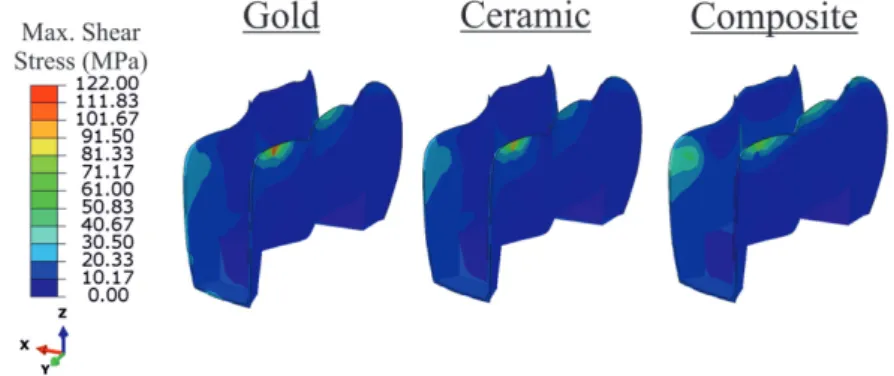 Fig. 12  Shear stress patterns under 200-N mechanical loading at 60°C for 2 s in adhesive resin.