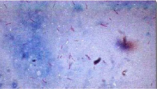 Şekil 2.2. EZN ile boyanmış preparatta M.tuberculosis basilleri 