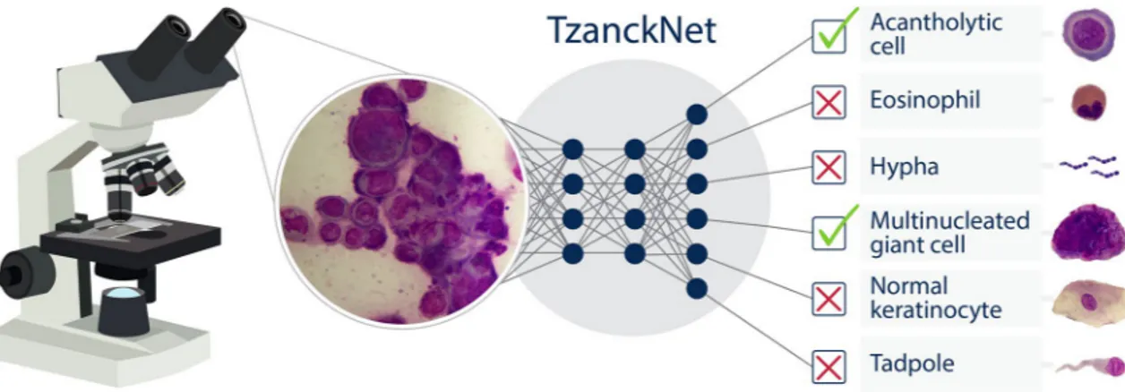 Figure 1.  A schematic showing how the proposed TzanckNet works. TzanckNet accepts a Tzanck smear 