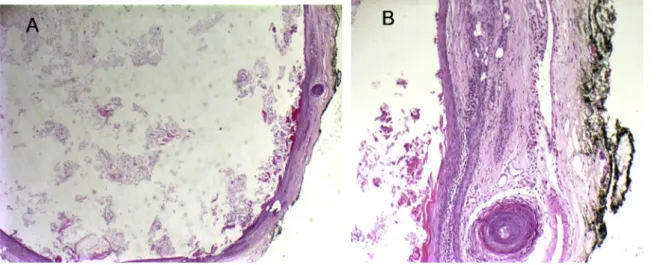 Figure 3. External photograph of the patient 1 week postoperatively.