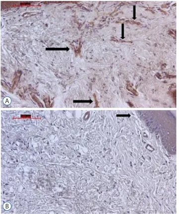 Fig. 6.  A : On the micrograph of group C the arrows point anti-NCAM  positive free nerve endings (original magnification, ×20, indirect  immunohistochemistry)