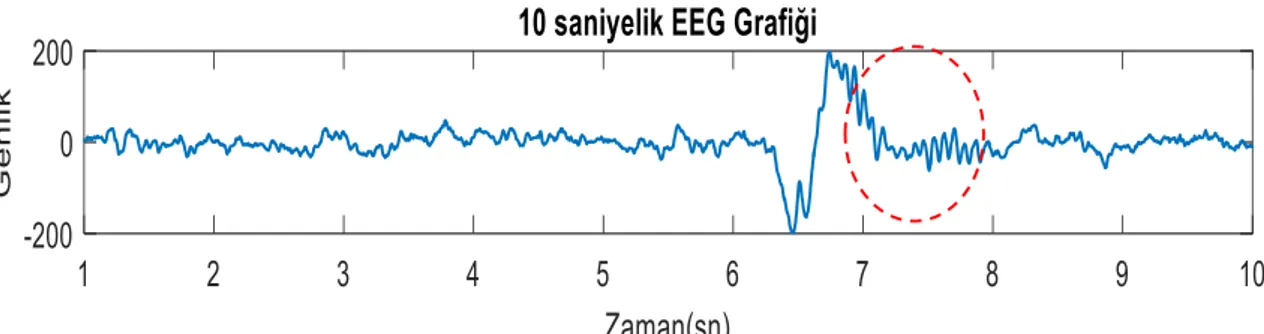 Şekil 2.7 7 ila 8. sn’ler arasında uyku iğciği bulunan EEG grafiği  2.4.3.  Arousal 