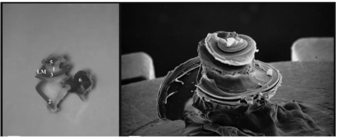 ġekil 2: Soldaki resim: Erişkin bir rat kokleası; Sağdaki resim: Rat kokleasının elektron mikroskopik 