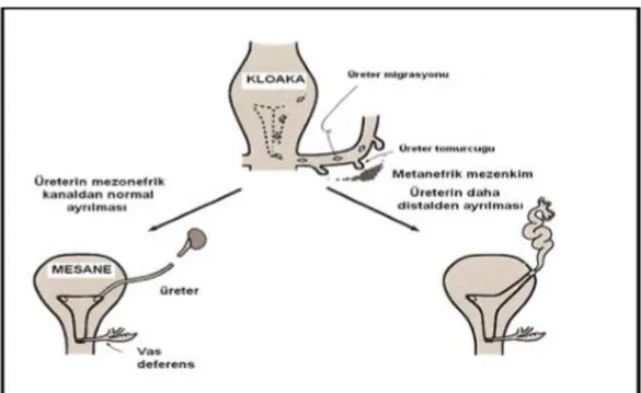 ġekil 2.10 Üreterin normal ve anormal ayrılması   2.3.2. Fonksiyonel geliĢim 