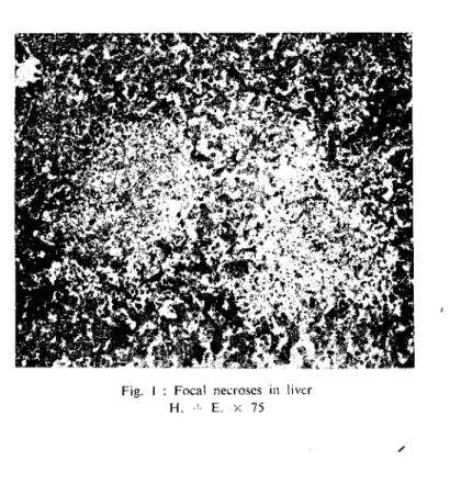 Fig. i : Focal necroscs in livcr H .. ,. E. x 75