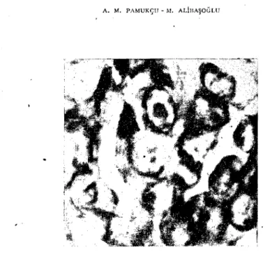 Fig. 2: intranııclcar İnclusions in bronchial epitheliums H. + E. /, 1200