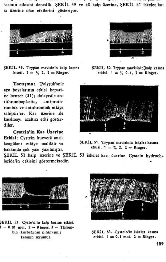 ŞEKIL 52. Cyste'n'in kalp kasını etkisi. 1 = 0.01 mol, 2 - Ringer, 3 = 