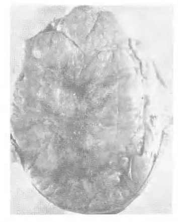 Fig. 1 Serninon ı a, testis, Ankara goat with unknown ege. 