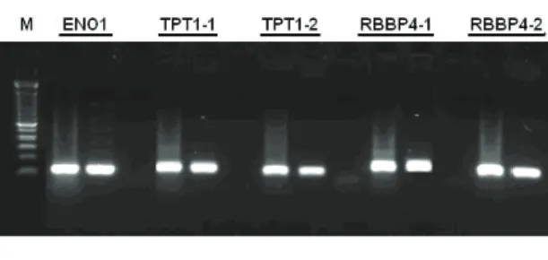 Şekil 2- ENO1, TPT1 ve RBBP4 genlerinde bulunan  SNP bölgelerine ait PCR ürünleri