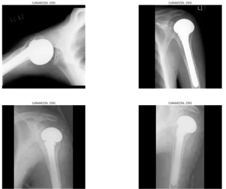 Figure 2. Sample shoulder implant X-ray images. Figure 1. Shoulder implant manufacturer count graph.