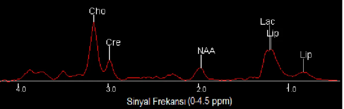 Şekil 3.3. Beyinden Elde Edilen Çok Vokselli MRS  Kaynak: (Nelson, 2003: 504) 