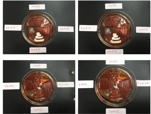 Şekil 4.6. Seçilen İzolatların Ksilan Enzim Test Sonuçlarının Örnek Petri Görüntüleri 