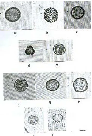 Şekil 1. a-b. C. album (a. Fosilize polen  b. Taze polen) x 1000 c. A. retroflexus  (Fosilize polen) x 1000 d-e