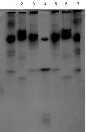 Fig 3. SDS-PAGE of the serum proteins of Leuciscus 