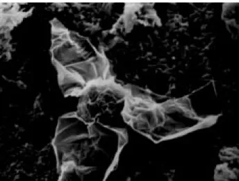 Fig. 4. Surface ornamentation on the spore body and three caudal processes of a aurantiactinomyxon type] spore