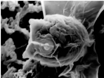 Fig. 7. Spore body of echinactinomyxon type 5 with very dense surface ridges. (x2500)