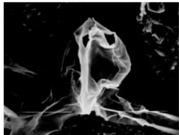 Fig. 15. An individual spore of synactinomyxon type 3 with a nearly discharged sporoplasm (x2500)