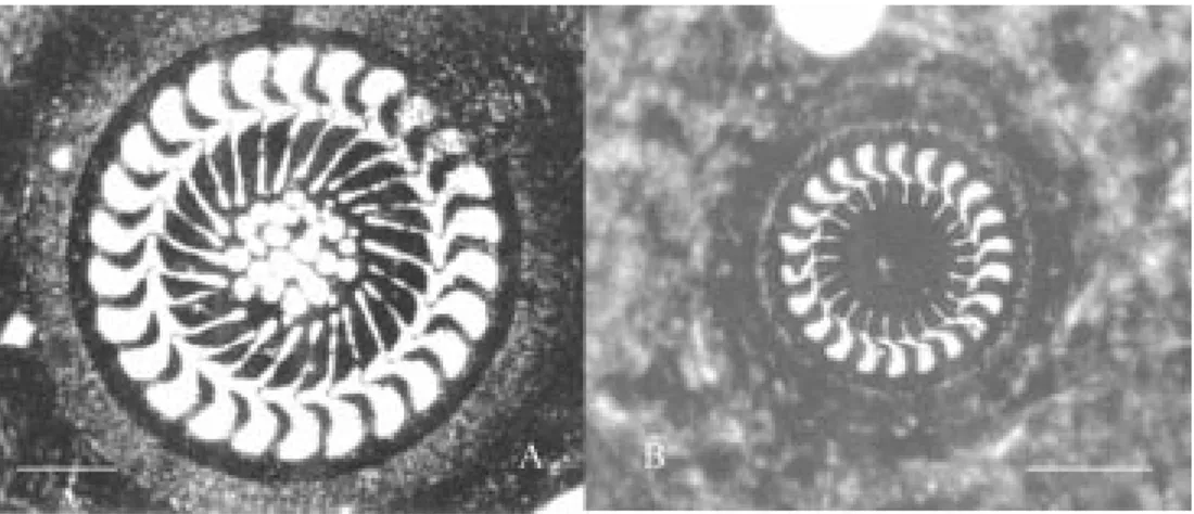 Figure 1. Klien’s silver nitrate stained specimens of Trichodina spp.  a. Trichodina puytoraci Lom, 1962